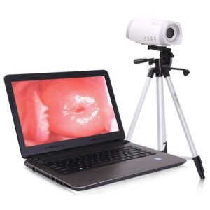 JHMVC05 Portable HD Digital Electronic Colposcope Gynecology Video System Digital Colposcope Machine for Cervical Examination